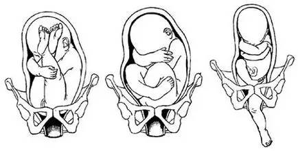 怀孕记-胎位不正怎么办?几个帮助胎儿转正的实用矫正方法